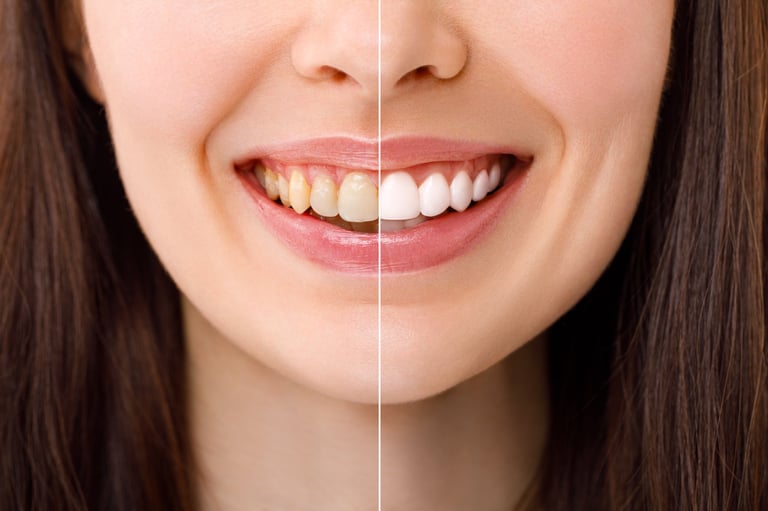 Smiling woman showing bright white teeth after professional teeth whitening procedure at Galleon Way Dental