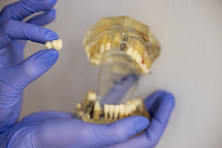 Close up of dentist using metal instrument to place and adjust dental bridge crown on transparent jaw model with visible posts highlighting precise fitting and prosthetic workflow
